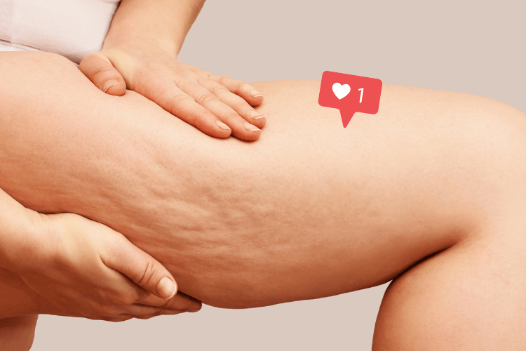 comment enlever la cellulite