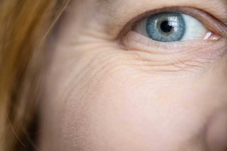le vieillessement de la peau coin de l'oeil cerne