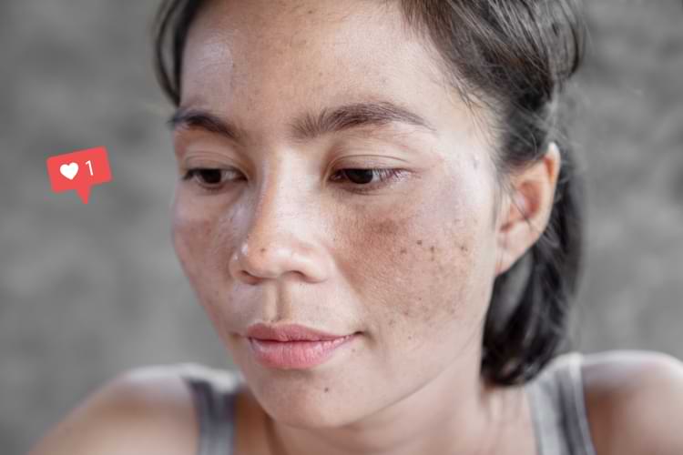 masque de grossesse